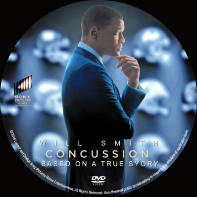 Concussion