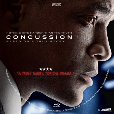 Concussion