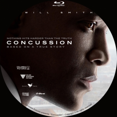 Concussion