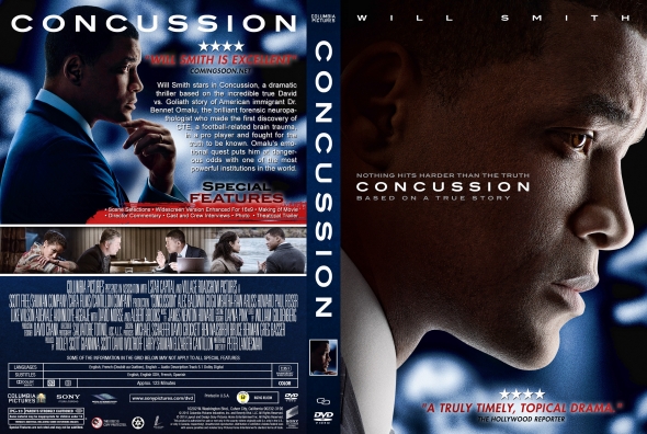 Concussion