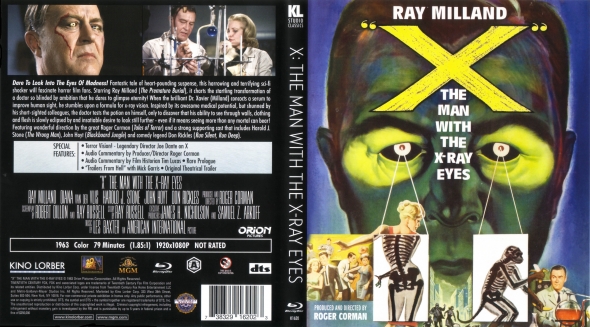 X: The Man with the X-Ray Eyes