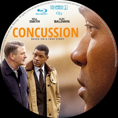 Concussion