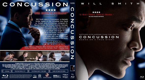 Concussion